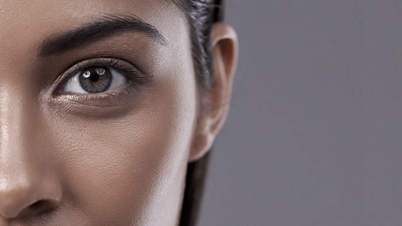 Under Eye Dark Circles - General Skin Concerns
